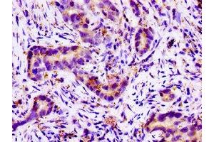 Immunohistochemistry (IHC) image for anti-Solute Carrier Family 11 (Proton-Coupled Divalent Metal Ion Transporters), Member 2 (SLC11A2) (AA 1-69) antibody (ABIN7161093)