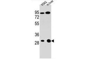 Western blot analysis of ETFA Antibody (C-term) Cat. (ETFA Antikörper  (C-Term))