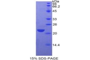 SDS-PAGE analysis of Human CLEC3B Protein. (CLEC3B Protein)