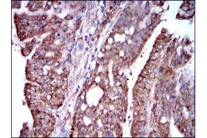 Immunohistochemistry (IHC) image for anti-Signal Transducer and Activator of Transcription 5A (STAT5A) (AA 583-794) antibody (ABIN1845625) (STAT5A Antikörper  (AA 583-794))