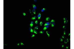 Immunofluorescence staining of Hela cells with ABIN7156385 at 1:133, counter-stained with DAPI. (ITM2B Antikörper  (AA 81-148))