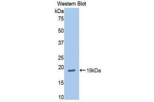 Western Blotting (WB) image for anti-Hexokinase 1 (HK1) (AA 530-675) antibody (ABIN1859171) (Hexokinase 1 Antikörper  (AA 530-675))