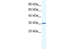 WB Suggested Anti-SNAPC2 Antibody Titration:  1. (SNAPC2 Antikörper  (Middle Region))