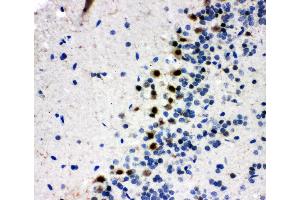 Immunohistochemistry (IHC) image for anti-V-Myb Myeloblastosis Viral Oncogene Homolog (Avian)-Like 2 (MYBL2) (AA 1-17), (N-Term) antibody (ABIN3044010)