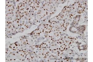 Immunoperoxidase of monoclonal antibody to CMAS on formalin-fixed paraffin-embedded human salivary gland. (CMAS Antikörper  (AA 164-263))