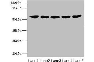 Western Blotting (WB) image for anti-Interleukin 28 Receptor, alpha (Interferon, lambda Receptor) (IL28RA) (AA 21-228) antibody (ABIN6098644)