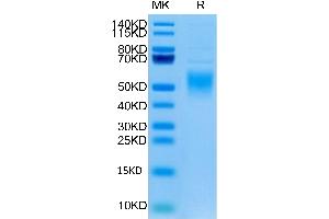 Human Fc epsilon RI alpha/FCER1a on Tris-Bis PAGE under reduced condition. (Fc epsilon RI/FCER1A Protein (AA 26-205) (His tag))