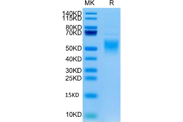 Fc epsilon RI/FCER1A Protein (AA 26-205) (His tag)