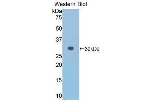 Western Blotting (WB) image for anti-Janus Kinase 2 (JAK2) (AA 564-809) antibody (ABIN1859523) (JAK2 Antikörper  (AA 564-809))