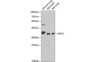 Western blot analysis of extracts of various cell lines, using MLF1 antibody (ABIN6128237, ABIN6143874, ABIN6143876 and ABIN6217281) at 1:1000 dilution. (MLF1 Antikörper  (AA 1-268))