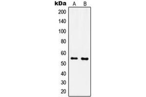 Western blot analysis of IPPK expression in MCF7 (A), NIH3T3 (B) whole cell lysates. (IPPK Antikörper  (N-Term))