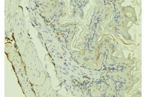 ABIN6273220 at 1/100 staining Mouse colon tissue by IHC-P. (CX3CL1 Antikörper  (Internal Region))