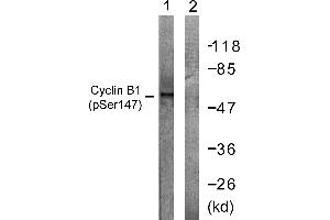 Immunohistochemistry analysis of paraffin-embedded human placenta tissue using Cyclin B1 (Phospho-Ser147) antibody. (Cyclin B1 Antikörper  (pSer147))
