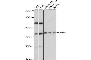 Western blot analysis of extracts of various cell lines, using CT antibody (ABIN6129529, ABIN6139174, ABIN6139175 and ABIN6217150) at 1:3000 dilution. (CTAGE1 Antikörper  (AA 370-520))