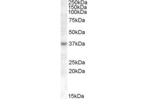 ABIN239124 (1µg/ml) staining of Jurkat cell lysate (35µg protein in RIPA buffer). (RASSF7 Antikörper  (Internal Region))