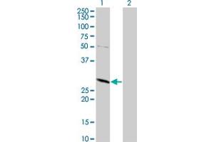 Western Blot analysis of TPMT expression in transfected 293T cell line by TPMT monoclonal antibody (M02), clone 1D4.