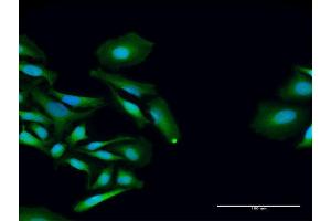Immunofluorescence of purified MaxPab antibody to PCID2 on HeLa cell. (PCID2 Antikörper  (AA 1-397))