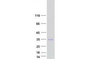 Western Blotting (WB) image for Basic Helix-Loop-Helix Family, Member E23 (BHLHE23) protein (Myc-DYKDDDDK Tag) (ABIN2715154)
