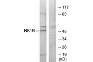 Western blot analysis of extracts from Jurkat cells, using NK1R Antibody. (TACR1 Antikörper  (AA 211-260))