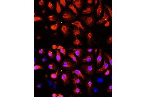 Immunofluorescence analysis of HeLa cells using  antibody (ABIN1678557, ABIN3017993, ABIN3017994, ABIN5664400 and ABIN6220331) at dilution of 1:100 (40x lens). (ACTN2 Antikörper  (AA 1-250))