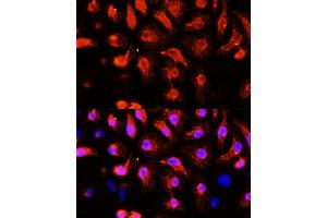 Immunofluorescence analysis of HeLa cells using  antibody (ABIN1678557, ABIN3017993, ABIN3017994, ABIN5664400 and ABIN6220331) at dilution of 1:100 (40x lens).