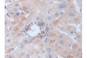 Detection of GLa in Human Liver Tissue using Polyclonal Antibody to Galactosidase Alpha (GLa) (GLA Antikörper  (AA 81-429))