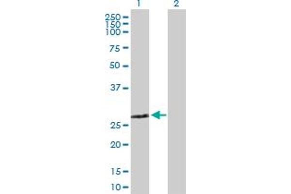 ZMYND19 antibody  (AA 1-227)