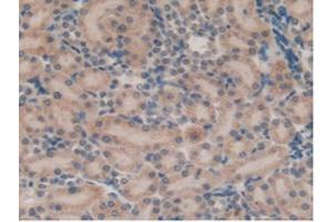 IHC-P analysis of Rat Kidney Tissue, with DAB staining. (SFTPB Antikörper  (AA 111-329))