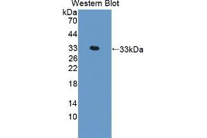 Detection of Recombinant IL22R, Rat using Polyclonal Antibody to Interleukin 22 Receptor (IL22R) (IL22R Antikörper  (AA 242-485))