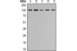 Western blot analysis of Collagen 4 alpha 1 expression in Hela (A), MCF7 (B), U2OS (C), HEK293T (D), VEC (E) whole cell lysates. (COL4A1 Antikörper)
