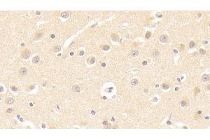 Immunohistochemistry (IHC) image for anti-Chaperonin Containing TCP1, Subunit 2 (Beta) (CCT2) (AA 1-488) antibody (ABIN7441646)