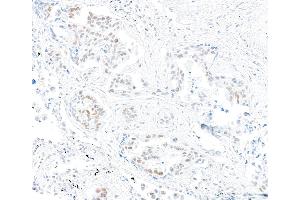 Immunohistochemistry (IHC) image for anti-Mismatch Repair Protein 2 (MSH2) (AA 625-675) antibody (ABIN7453978) (Rekombinanter MSH2 Antikörper  (AA 625-675))