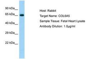 Image no. 1 for anti-Collagen, Type VI, alpha 5 (COL6A5) (AA 2427-2476) antibody (ABIN6750094) (Collagen, Type VI, alpha 5 (COL6A5) (AA 2427-2476) Antikörper)