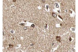 ABIN6276654 at 1/100 staining human brain tissue sections by IHC-P. (BDNF Antikörper  (Internal Region))