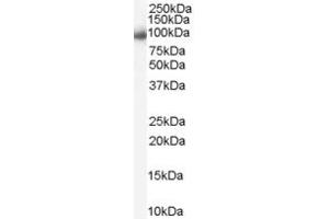 Western Blotting (WB) image for anti-Aurora Kinase A (AURKA) (Middle Region) antibody (ABIN2785452) (Aurora A Antikörper  (Middle Region))