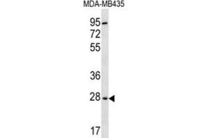 Western Blotting (WB) image for anti-2,3-bisphosphoglycerate Mutase (BPGM) antibody (ABIN2996852) (BPGM Antikörper)