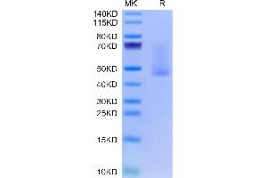 SDS-PAGE (SDS) image for Syndecan 1 (SDC1) (AA 23-254) protein (His tag) (ABIN7275681)