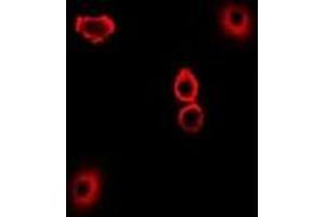 Immunofluorescent analysis of TXNL1 staining in U2OS cells. (TXNL1 Antikörper)