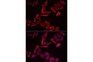 Immunofluorescence analysis of MCF7 cells using SK antibody . (SKAP2 Antikörper  (AA 1-120))