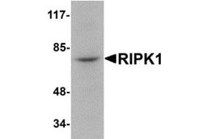 Western Blotting (WB) image for anti-Receptor (TNFRSF)-Interacting serine-threonine Kinase 1 (RIPK1) (N-Term) antibody (ABIN1031543) (RIPK1 Antikörper  (N-Term))