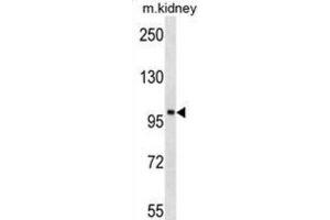 Western Blotting (WB) image for anti-tyrosine Kinase, Non-Receptor, 2 (TNK2) antibody (ABIN3003439) (TNK2 Antikörper)