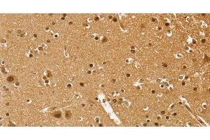 Immunohistochemistry of paraffin-embedded Human brain using PSMC1 Polyclonal Antibody at dilution of 1:40 (PSMC1 Antikörper)