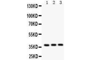 Anti- IL3 antibody, Western blotting All lanes: Anti IL3  at 0. (IL-3 Antikörper  (AA 28-166))