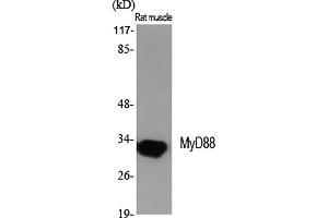 Western Blot analysis of various cells using MyD88 Polyclonal Antibody diluted at 1:2000. (MYD88 Antikörper  (Internal Region))