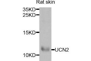 Western blot analysis of extracts of rat skin, using UCN2 antibody (ABIN5973879) at 1/1000 dilution. (Urocortin 2 Antikörper)