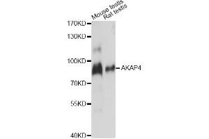 Western blot analysis of extracts of various cell lines, using AKAP4 antibody. (AKAP4 Antikörper)