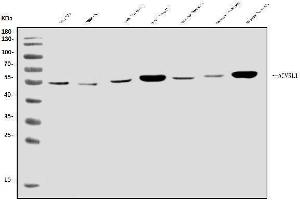 Western blot analysis of ALK-1/ACVRL1 using anti-ALK-1/ACVRL1 antibody (ABIN7601037).