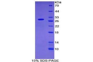 SDS-PAGE (SDS) image for Oncoprotein Induced Transcript 3 (OIT3) (AA 297-506) protein (His tag) (ABIN2126199)