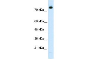 WB Suggested Anti-ZMYM3 Antibody Titration:  2. (ZMYM3 Antikörper  (N-Term))