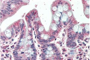 ABIN570797 (5µg/ml) staining of paraffin embedded Human Small Intestine. (EML5 Antikörper  (Internal Region))